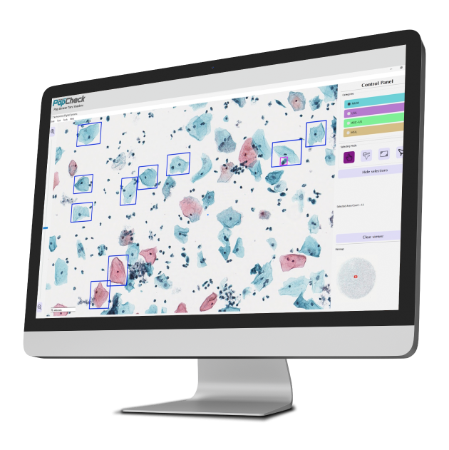 Artificial Intelligence Supported Pap Smear Diagnostic Software